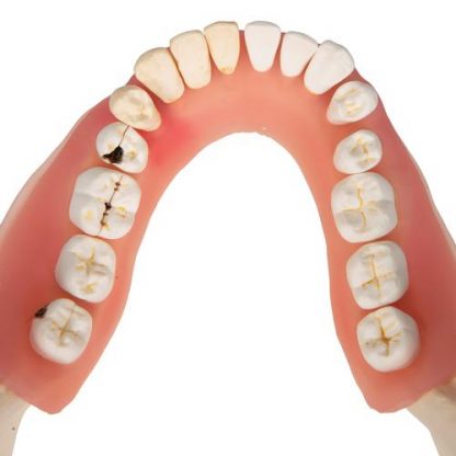 Choroby zębów_6