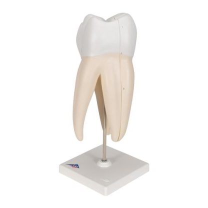 Model górnego zęba trzonowego_1