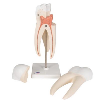 Model górnego zęba trzonowego_2