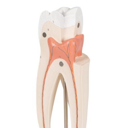 Model górnego zęba trzonowego_3