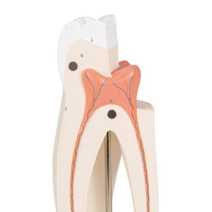 Model górnego zęba trzonowego_4