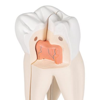 Model górnego zęba trzonowego_5