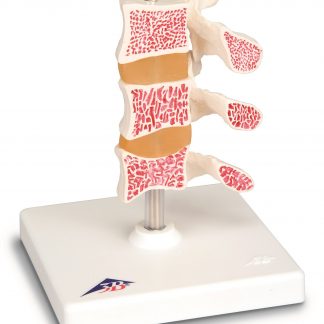 Model osteoporozy