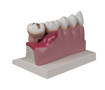 Model zębów 4 krotne powiększenie_1