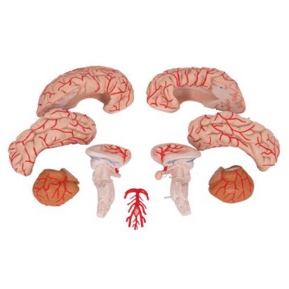Mózg z tętnicami 5
