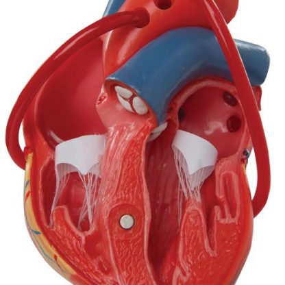 Model serca z bajpasami 2