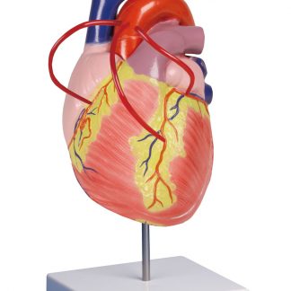 Model serca z bypassami