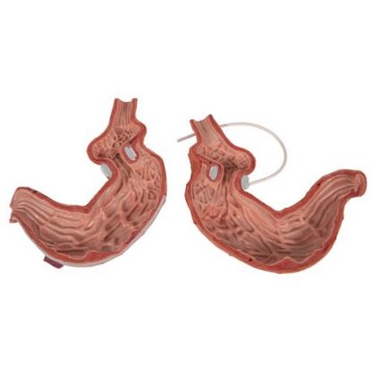 Model żołądka z SAGB_5