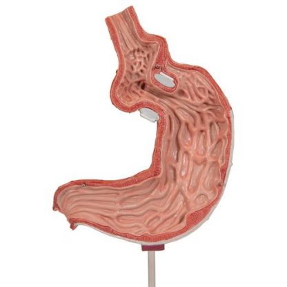 Model żołądka z SAGB_6