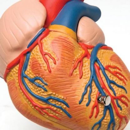 Serce z przerostem lewej komory 1