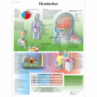 Bóle głowy