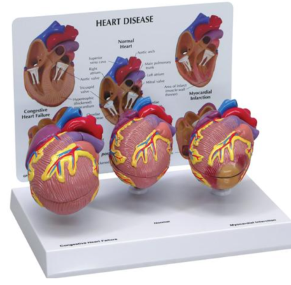 Model chorób serca