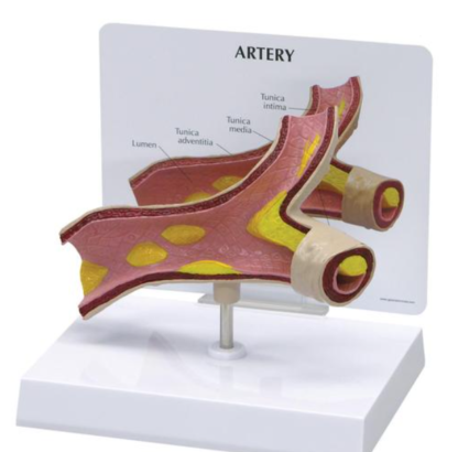 Model tętnicy ze zmianami miażdżycowymi